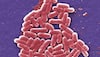 Superbug NDM-1: What you need to know, why it's so dangerous!