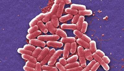 Superbug NDM-1: What you need to know, why it's so dangerous!