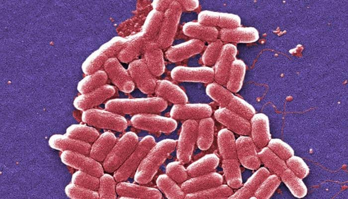 Superbug NDM-1: What you need to know, why it's so dangerous!