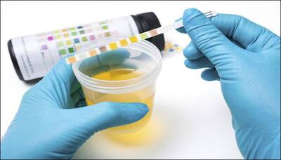How healthy is your diet? This new urine test can reveal the truth