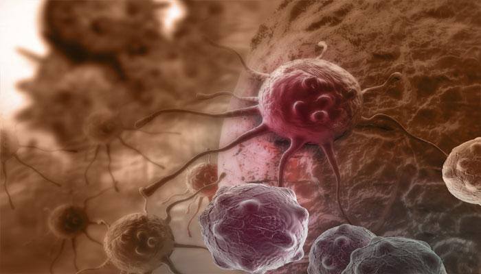 Researchers believe thick skin on palms, soles may be associated with oesophageal cancer