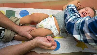 Union Health Ministry starts Measles-Rubella vaccine campaign 