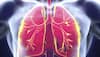 Researchers develop new 3D system to fight tuberculosis