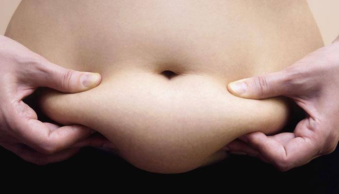 This is how world's heaviest people fared post weight loss surgery