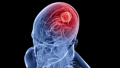 People with brain injuries likely to develop attention problems