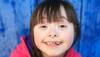 Down syndrome: What causes this congenital disorder, everything you need to know