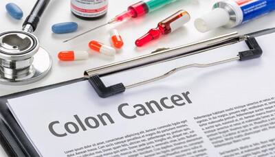 Colon cancer patients have some hope with new immune therapy – Read story