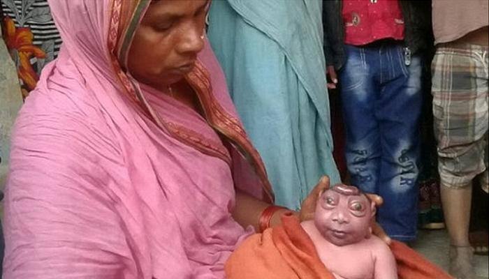 Baby born with rare condition labelled 'alien' by shocked mom who refused to nurse him