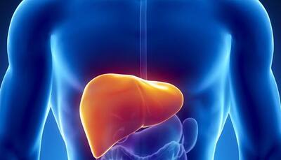 Too much iron in body may damage liver, say doctors