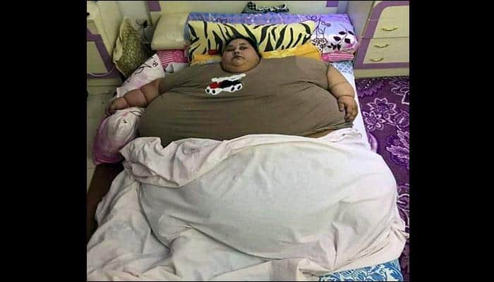 World&#039;s heaviest woman Eman Ahmed suffers from rare gene defect causing obesity
