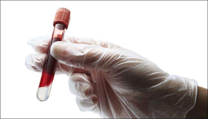 New blood test for speedy heart attack diagnosis