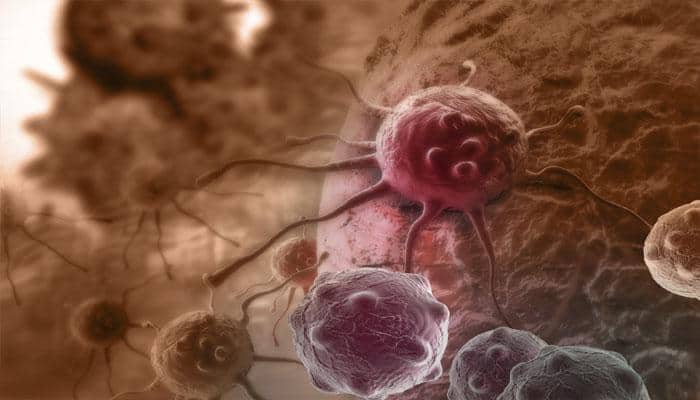 Strand Life Sciences launches liquid biopsy test to detect cancer