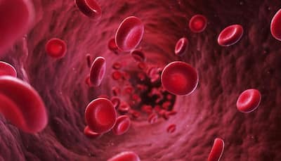 Aplastic Anaemia: All you need to know about it!