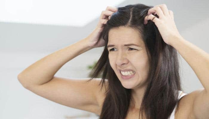 Know these common causes of chronic itchy scalp!