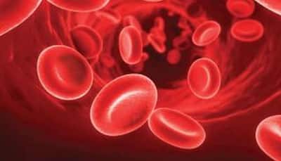 World Haemophilia Day 2017: Know the different types, symptoms of bleeding disorders