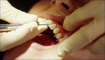Oral cancer: Early detection can help boost chances of survival