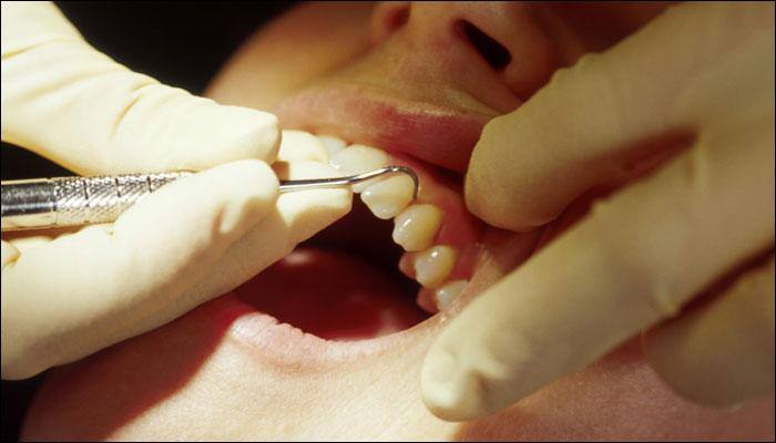 oral problem public health cancer Breaking Oral  cancer   Read cancer Latest  News on Oral