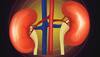 Experts urge everyone to make kidney health a priority 