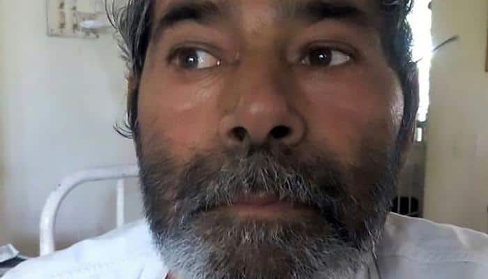 This man from Kota lives with 75 pins inside his body, doctors in a fix