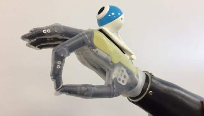 This new bionic hand offers new hope to amputees! Here&#039;s why