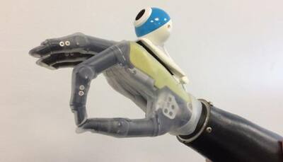 This new bionic hand offers new hope to amputees! Here's why