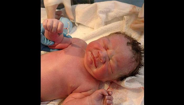 Newborn baby holds mother&#039;s birth control device! Was he born with it?