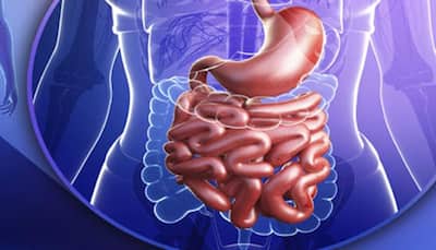 Colorectal cancer: Things that can increase your risk