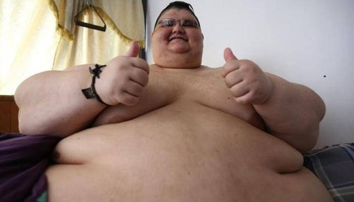After Eman Ahmed, world's heaviest man Juan Pedro Franco undergoes successful weight loss surgery in Mexico