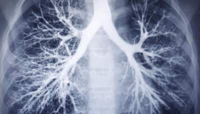 Quit-smoking drug safe for patients with chronic lung conditions