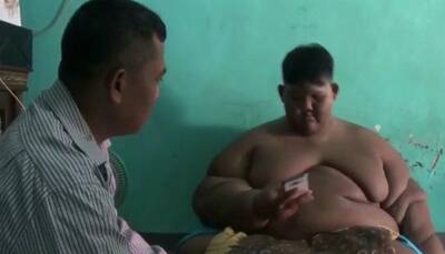 Indonesian boy weighing 30 stone after cola and noodle addiction undergoes successful bariatric surgery