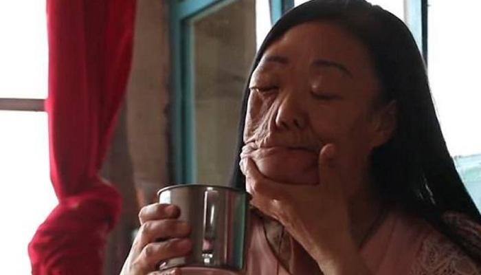 People call her 'elephant face' due to facial tumours, online medium gives her love – Read the ordeal of 48-year-old Liu Ying