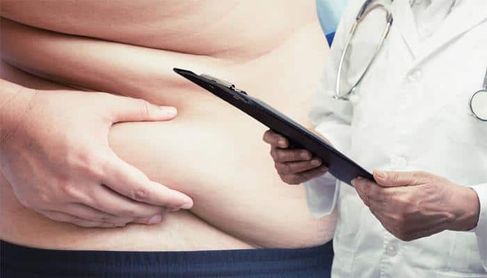 Obesity can cause cardiovascular diseases even in young