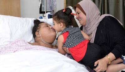 Eman Ahmed, once world's heaviest woman, eats food by herself for first time in 25 years