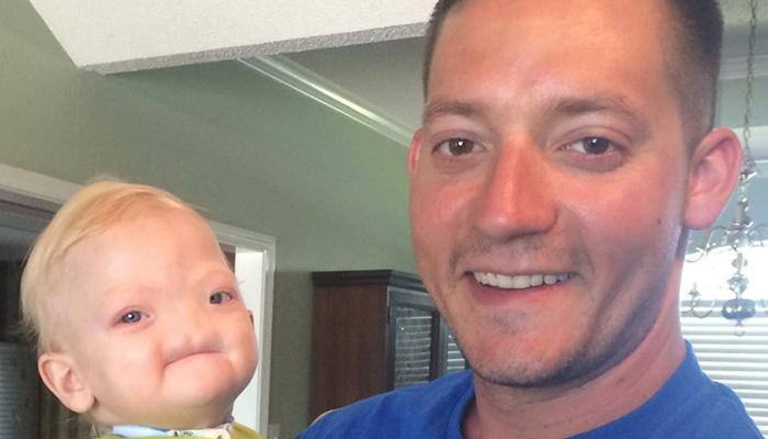 A father&#039;s heartfelt message on son&#039;s death - Alabama &#039;miracle baby&#039; born without nose dies at 2