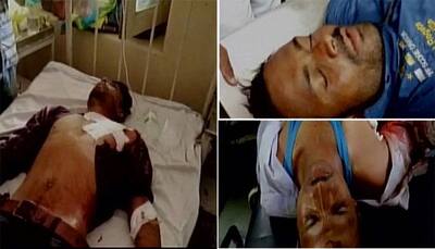 MP: Farmers' protest turns violent as four killed in police firing in Mandsaur; Assn calls for bandh tomorrow 