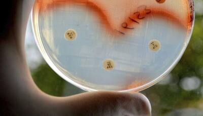WHO's new recommendations on use of antibiotics to counter superbug infections
