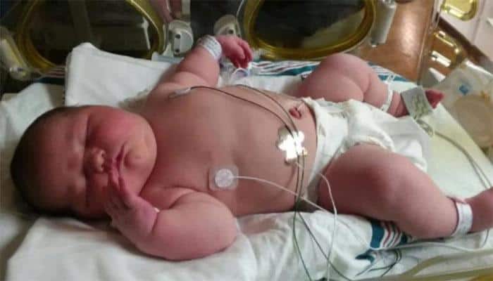 US woman delivers &#039;Big Baby&#039;, gives birth to 13-pound girl through C-section