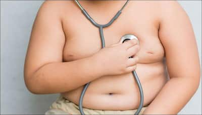 India harbours second highest number of obese children in the world; China tops list!