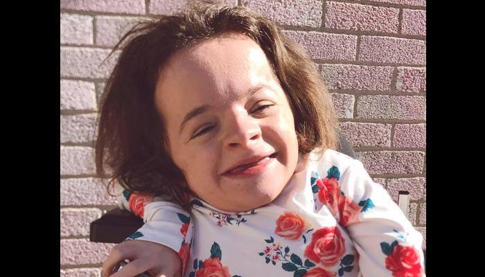 Meet this 18-year-old vlogger who has a bone like 'chalk'!