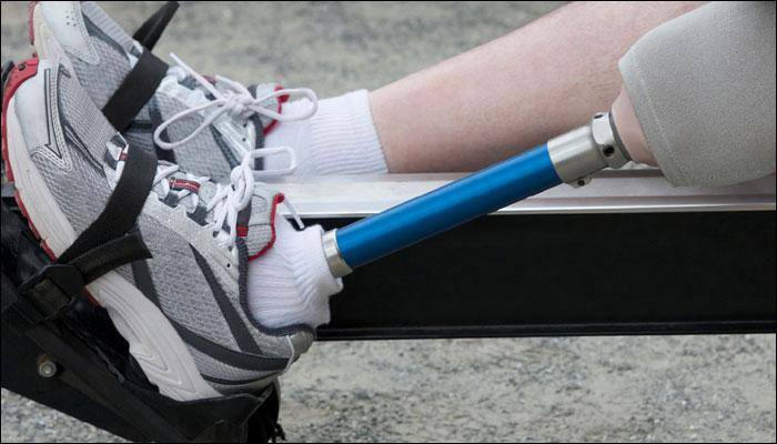 Soon, prosthetic limbs that take feedback from human body