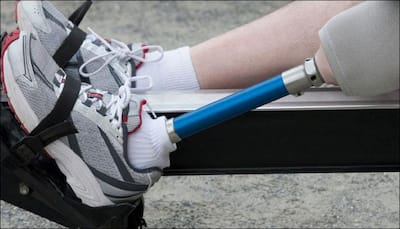 Soon, prosthetic limbs that take feedback from human body