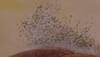 Sick building syndrome: Fungal toxins in your house can make you ill