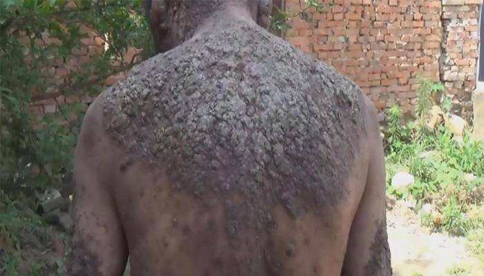 58-year-old lives in isolation, branded as 'bark man' in China — Here's why