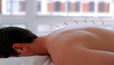 Want to shed those extra kilos? Add acupuncture in your weight loss plan!