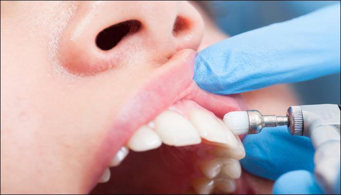 Diabetes can put you at tooth loss risk – Here's how