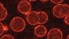 tumour cells