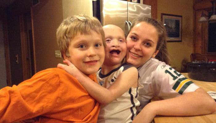 This nine-year-old boy is unable to cry or sweat – Find out why!