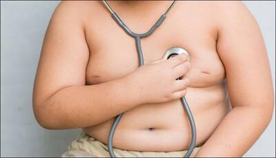 Obesity in teenage may up colon cancer risk later