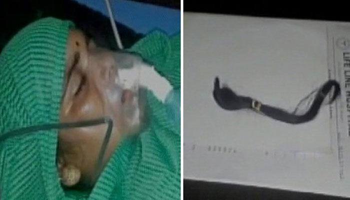 Braid chopping mystery continues; Now, middle-aged woman's tresses cut in Uttarakhand Braid chopping mystery continues; Now, middle-aged woman's tresses cut in Uttarakhand