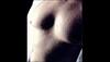 Teenage boy grows breast on right side of his chest; doctors blame it on 'over-consumption of fast-food'